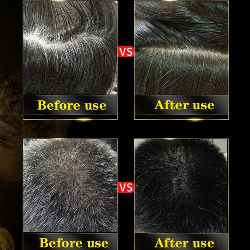 3 in 1 Black Hair Dye Shampoo - Buy 1 Get 1 Free