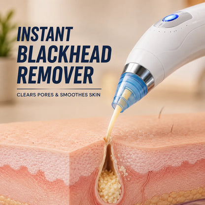4-in-1 Blackhead Removal With Free Mens Trimmer