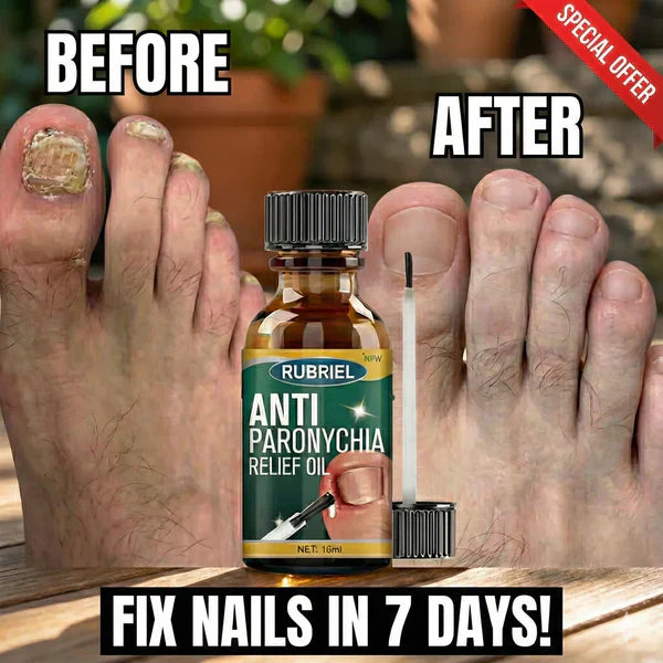 Anti Paronychia Relief Oil - (Buy 1 Get 1 FREE)