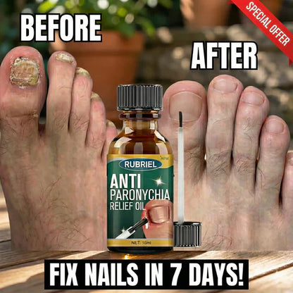 Anti Paronychia Relief Oil - (Buy 1 Get 1 FREE)