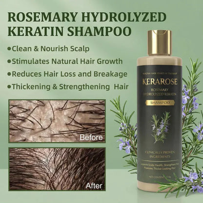 Kerarose Rosemary Shampoo For Hair Growth (Buy 1 Get 1 Free 🔥🔥)